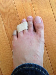 人生初骨折… 人生初骨折…
